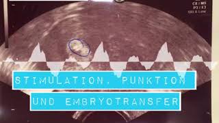 4ICSI  Stimulation Punktion und Embryotransfer was diesmal anders lief [upl. by Regdor]