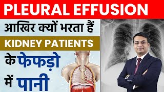 प्ल्यूरल इफ्यूशन फुफ्फुस बहाव क्या है Pleural Effusion in Hindi  Dr Puru Dhawan [upl. by Jacobson]