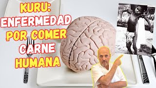 🚨 KURU LA ENFERMEDAD QUE DA POR COMER CARNE HUMANA 🚨 CAUSAS SÍNTOMAS Y TRATAMIENTO [upl. by Raama]