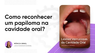 Como reconhecer um papiloma na cavidade oral  Prof Mônica Israel [upl. by Anined326]