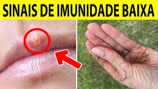 10 Sinais de IMUNIDADE BAIXA Que Você Não Deve Ignorar [upl. by Eisus]