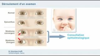 Examen ophtalmologique et dépistage des anomalies oculaires chez lenfant [upl. by Eglantine208]