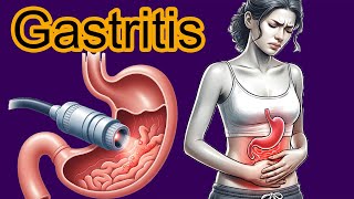 5 Early signs of Gastritis Gastritis diagnosis and treatment [upl. by Ayoral]