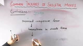 Contusions  Common injuries of skeletal muscle  Biomechanics of skeletal muscle [upl. by O'Driscoll]