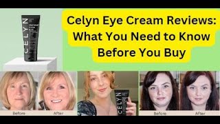 Celyn Eye Cream Reviews what you need to Know [upl. by Peony]