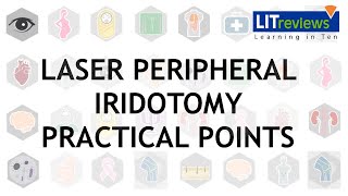 Laser Peripheral Iridotomy Practical Point [upl. by Jerol472]