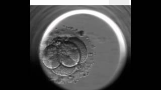 EmbryoScope  artificial fertilization technique [upl. by Torrey]