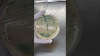 Burkholderia cepacia Trên Môi Trường Thạch UTI  Điều Bạn Cần Biết shorts labinsight [upl. by Rabin]