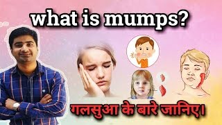 MUMPS  CAUSES  SYMPTOMS  TREATMENT  HINDI [upl. by Notniw]