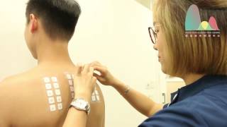 skin patch test hong kong allergen patch test  MedDx Allergy hong kong [upl. by Hally]