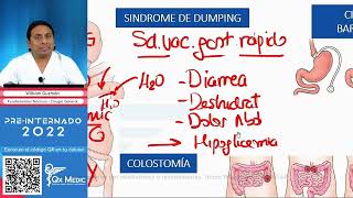 CIRUGIA BARIATRICA  Gastrointestinal  QX MEDIC  Cirugía Medica [upl. by Novaelc]