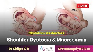 Obstetrics Masterclass Shoulder Dystocia and Macrosomia  Dr Shilpa G B  Dr Padmapriya Vivek [upl. by Heater936]