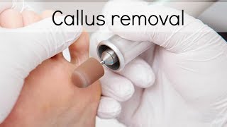 How to Callus Removal with electric nail file [upl. by Lledroc]