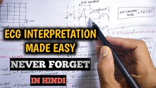 ECG interpretation made easy  How to read ECG in hindi [upl. by Nesahc]