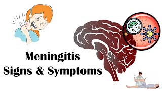 What Meningitis Vaccine do Most Teenagers Need Fact Check FAQs on Kids Vaccines  AAP [upl. by Carolann313]