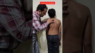 Treatment of Scoliosis scoliosis treatment spine explore trending chiropractic [upl. by Kcitrap]