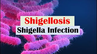 Shigellosis Shigella “A Cause of Bloody Diarrhea” Pathophysiology Symptoms Diagnosis Treatment [upl. by Rolyks]