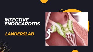 Infective Endocarditis [upl. by Jimmie]