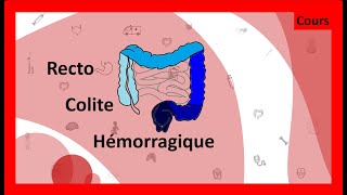 Questce que la rectocolite hémorragique 🤢💩  Cours  HépatoGastroEntérologie [upl. by Ccasi508]