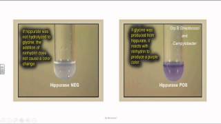 Group B Streptococci or Streptococcus Agalactia [upl. by Moersch]