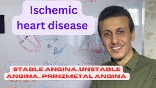 الذبحة الصدرية انواعها واسبابها  angina pec unstable angina prinzmetal angina [upl. by Adorne]