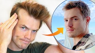 How I Stopped My Receding Hairline Mens Hair Loss Guide [upl. by Nibor804]