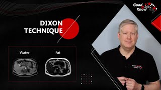 Good To Know  The Dixon Technique [upl. by Perri]