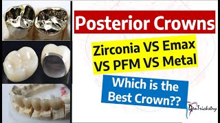 DENTAL CROWN TYPES Zirconia Emax PFZ PFM Metal Choosing the BEST [upl. by Debbee]