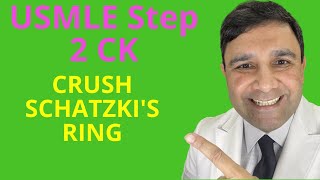 USMLE Step 2 CK score 270 series  Schatzkis ring [upl. by Otinauj482]