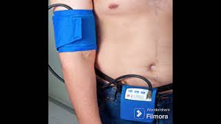 Holter pressorio monitoraggio pressione arteriosa 24h [upl. by Eidson528]