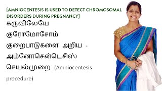 அம்னோசென்டெசிஸ் Amniocentesis  கருவிலேயே குரோமோசோம் குறைபாடுகளை அறிய [upl. by Eedna]