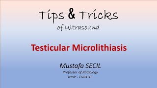 Tips amp Tricks of US  Testicular Microlithiasis ultrasound cancer testis [upl. by Inor]