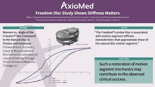 AxioMed Freedom Disc Study Shows Stiffness Matters [upl. by Eceryt]