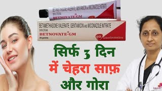 Betnovate  Gm Skin Cream के चमत्कारी फायदे Honest Review  स्किन को सच में गोरा करता हे ये क्रीम [upl. by Kippar808]