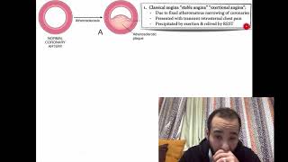 introduction to pharmacology of ischemic heart disease  Arabic [upl. by Kelila863]