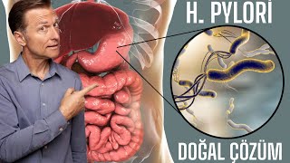 Helicobacter Pyloriye H Pylori Karşı 6 Doğal Çözüm  DrBerg Türkçe [upl. by Aiyotal196]