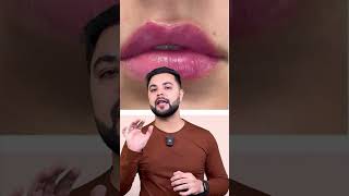 Transform Your Lips 100 Effective Dark Lip Pigmentation Treatment at Home [upl. by Zacharia]