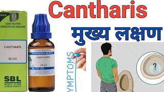 Cantharis 30200ch q mother tincture homeopathy medicine uses in hindi [upl. by Vinnie]