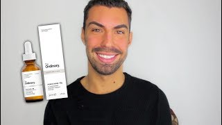 THE ORDINARY MANDELIC ACID  WHEN TO USE [upl. by Llerrehs469]