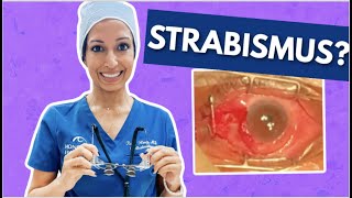 What To Expect With Strabismus Surgery  Eye Surgeon Explains [upl. by Day651]