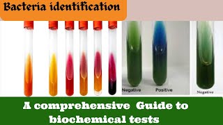 Identify Bacteria FAST with this Biochemical Test Microbiology [upl. by Lorant504]