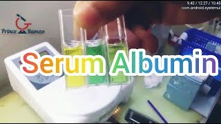 S Albumin Test Procedure in bangla সম্পুর্ন বাংলায় Prince Laboratory [upl. by Aihsekyw]