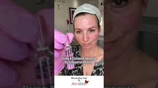 Microneedling AntiAging Facial Boost Collagen for Youthful Skin [upl. by Archangel]