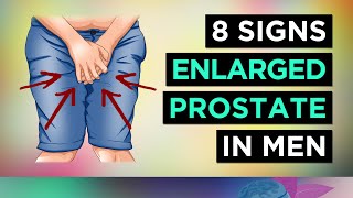 8 Signs You Have ENLARGED Prostate BPH  Men [upl. by Eiblehs552]