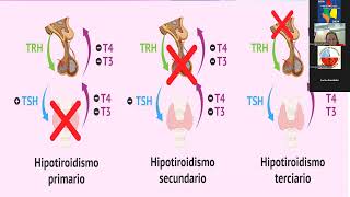 Video 6º Módulo ENDOCRINOLOGÍA Patología Tiroidea  Curso NOA 2024 [upl. by Anaid]