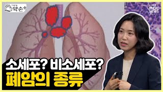 소세포 폐암 비소세포 폐암 폐암의 종류 폐암의 진단과 치료 ④  메디컬 약손 [upl. by Dragon300]