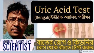 Uric Acid Test Explained ইউরিক অ্যাসিড টেস্ট Serum Uric Acid Test সিরাম ইউরিক অ্যাসিড টেস্ট [upl. by Anazraf371]