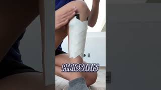 Vendaje funcional para PERIOSTITIS kinetape vendaje periostitis [upl. by Thagard]