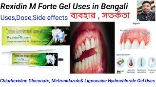 Rexidin M Forte Gel Uses in Bengali languageChlorhexidineGluconateMetronidazole Lignocaine uses [upl. by Asenev59]