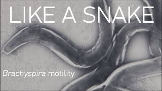 Snake like motion on a tiny scale  Brachyspira [upl. by Tuckie]